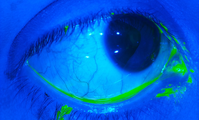 Wavefront aberrometer technology for specialty lens evaluation