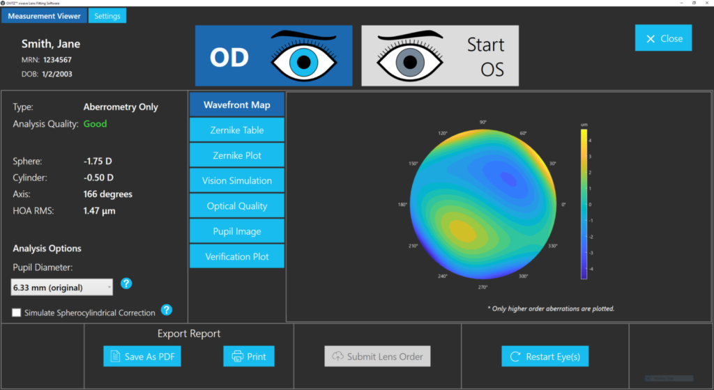 Wavefront map used in advanced scleral lens planning