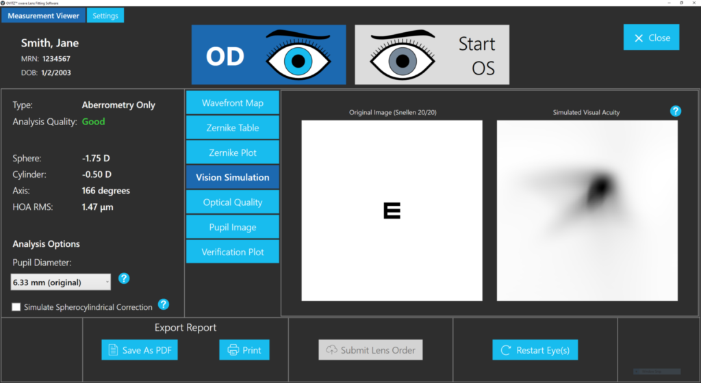 Wavefront map used in advanced scleral lens planning