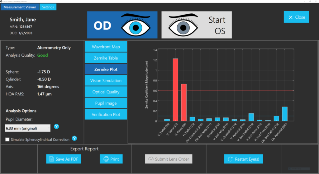 Wavefront map used in advanced scleral lens planning