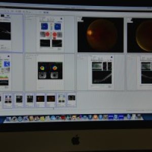 advanced-digital-retinal-imaging-and-telemedicine-5